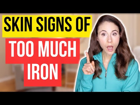 9 SIGNS OF TOO MUCH IRON // DERMATOLOGIST @DrDrayzday