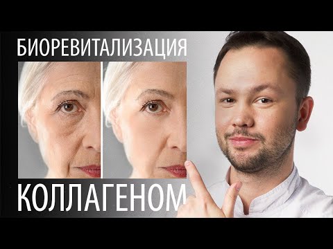 Biorevitalization without hyaluronic acid. Collagen for the skin.