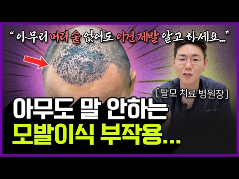 모발이식을 하면 안되는 7가지 경우 "이게 걱정인 분들은 모발이식 수술 절대 하지마세요!"