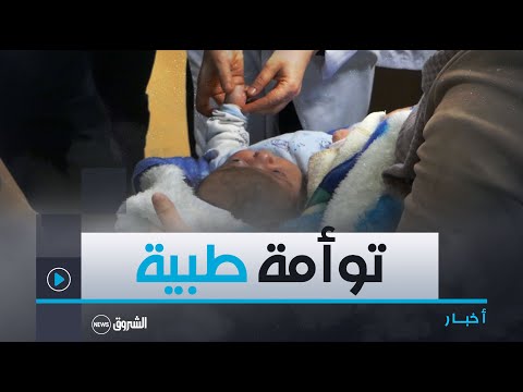 #وهران| اتفاقية بين مستشفي #أول_نوفمبر و#تور بفرنسا لجراحة #الفك و#الوجه