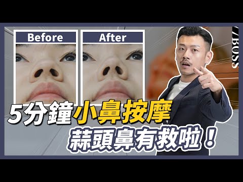 塌鼻扁鼻救星，5分鐘小鼻按摩術！變挺變翹、雕塑鼻型！兩周效果超驚人！【77老大】