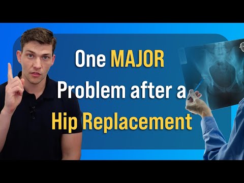 Watch Out for THIS Problem after Hip Replacement
