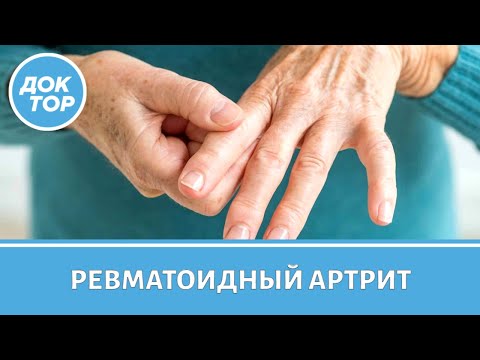 Как жить с ревматоидным артритом