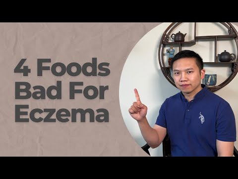 AVOID These 4 Foods to Prevent ECZEMA Flare Up
