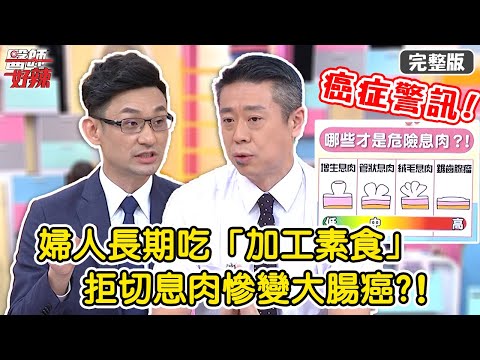 癌症警訊！婦人長期吃「加工素食」，拒切息肉慘變大腸癌？！【#醫師好辣】20220407 完整版 危險罹癌警訊 EP1310 陳榮堅 張振榕 許瓊月