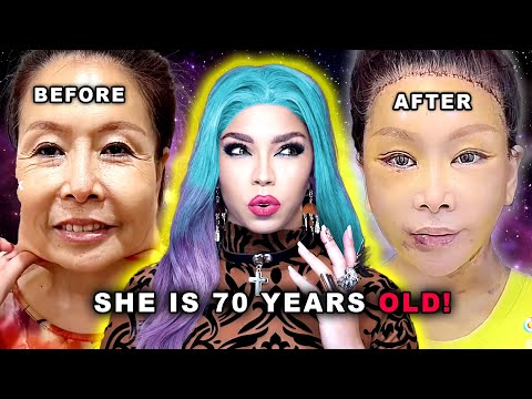 TikTok’s UNHINGED Plastic Surgeon is OUT OF CONTROL | Dr. Kim