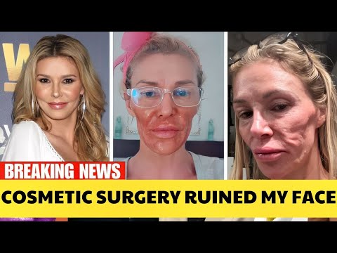 You Won’t Believe These 5 Plastic Surgery Fails | Hollywood Then & Now 2026