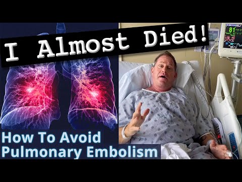 What Men on TRT & Steroids MUST DO Before Surgery to Avoid Pulmonary Embolism - Doctor's Experience!