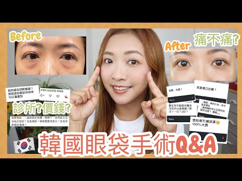 ♥ BYEBYE眼袋#2 ♥ 眼底脂肪重置手術Q&A💬究竟是怎樣的價錢令我衝去韓國動手術？🤑動刀為什麼沒傷口？❤️‍🩹診所醫生資料超～～詳細分享📝 || Dottie Hidee ||