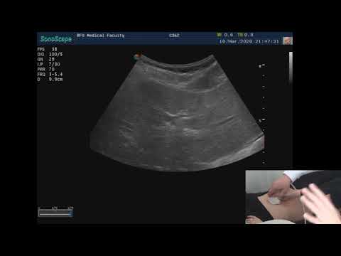 УЗИ печени. Практическое занятие