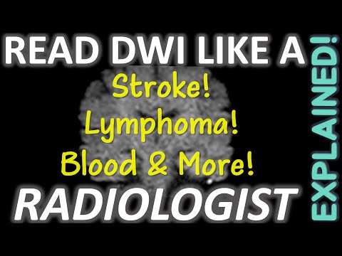 How to Read MRI Diffusion Imaging (DWI) like a Real Radiologist
