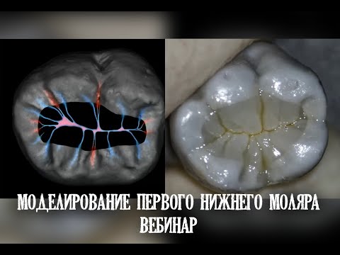 Моделирование первого нижнего моляра. Вебинар