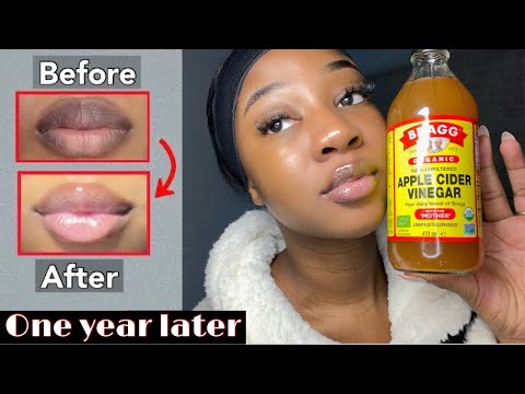 HOW I LIGHTENED MY LIPS QUICK WITH ONE PRODUCT - Updated‼️(Permanently)