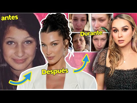 Bella Hadid: La Verdad Detrás de la Modelo que NO SOPORTA Mirarse al Espejo Parte 2
