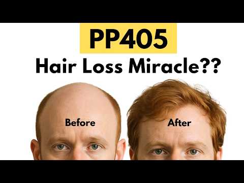 Can PP405 Stop Hair Loss?! | New Hair Loss Medication