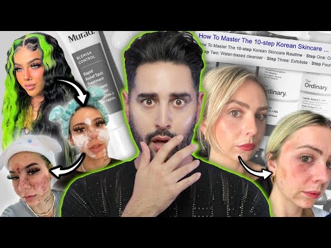 Becoming A Skincare Junkie Ruined Their Skin! When Beauty Turns Ugly