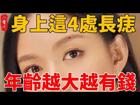 身上這4處長痣，男女皆富貴，一生好命，年齡越大越有錢！