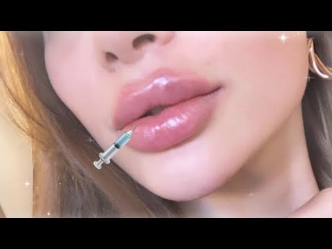 ♡ֹྀི 𝐑𝐔𝐒𝐒𝐈𝐀𝐍 HEART-SHAPED LIPS IN AN INSTANT 💉✨ [ permanent filler by dr. lux ] ☆