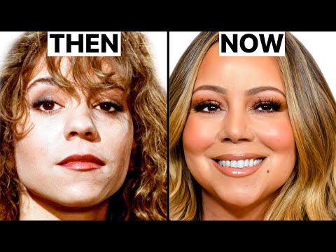 Mariah Carey New Face | Plastic Surgery Analysis