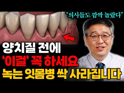 "양치질, 치실 아닙니다" 양치 전에 매일 먼저하면 잇몸병 사라지고 잇몸이 튼튼해집니다 (박창진 원장 2부)