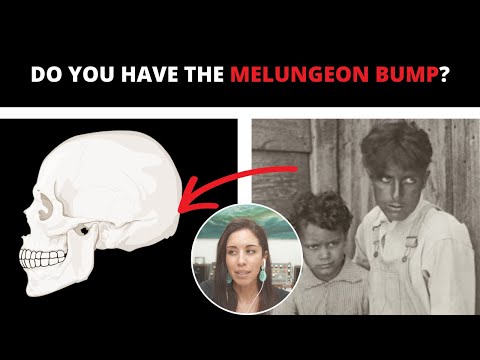5 Traits That Could Mean You’re Melungeon