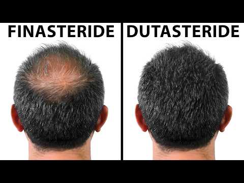 Which Is The Best Medication For Hair Loss: Finasteride or Dutasteride?
