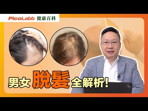 次次洗完頭，去水位都塞滿頭髮？｜男女脫髮｜健康百科