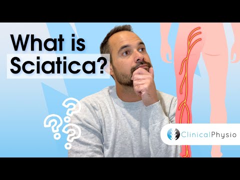 What is Sciatica?! | Expert Physio explains anatomy, diagnosis and key strategies for treatment!