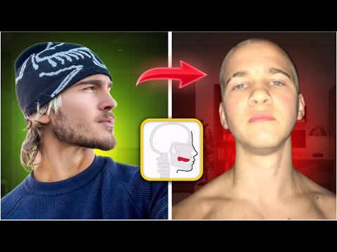 MEWING IS MAKING YOU UGLIER (here’s why)