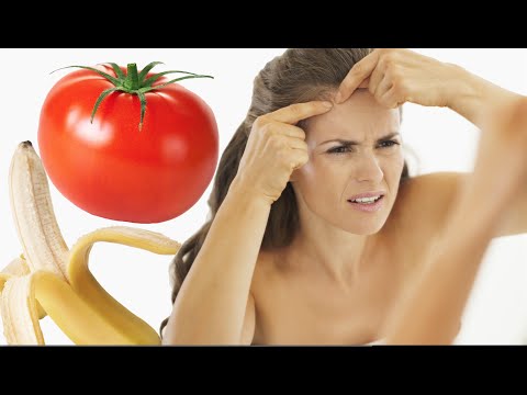 18 Pimple Hacks You Need To Try