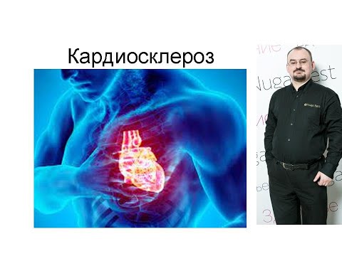 Кардиосклероз – проявление и лечение.