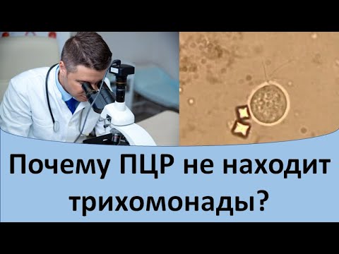 Почему ПЦР не находит трихомонады