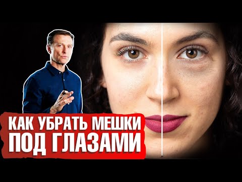 Мешки под глазами: как убрать? Какая причина отека под глазами? 👁