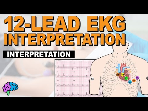 The SIMPLE Steps of 12-Lead EKG Interpretation - EXPLAINED CLEARLY!