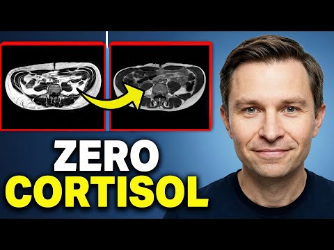 This Will Get You to 0% Visceral Fat in 30 Days! (Drops Cortisol) | Dr. David Sinclair