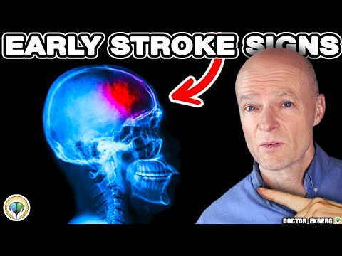 10 Warnings Signs Of STROKE A Week BEFORE It Happens