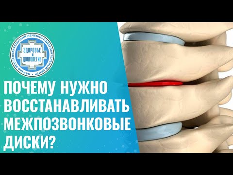 👉 Почему нужно восстанавливать межпозвонковые диски?