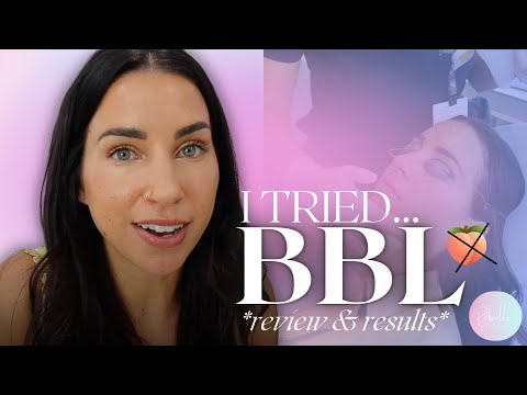 My BBL Laser Results + honest review // REBELLE NUTRITION