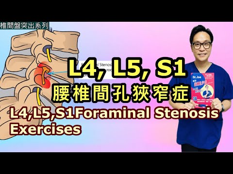 L4,L5,S1 腰椎間孔狹窄症［Eng Subtitles]  L4,L5,S1 Foraminal Stenosis Exercises