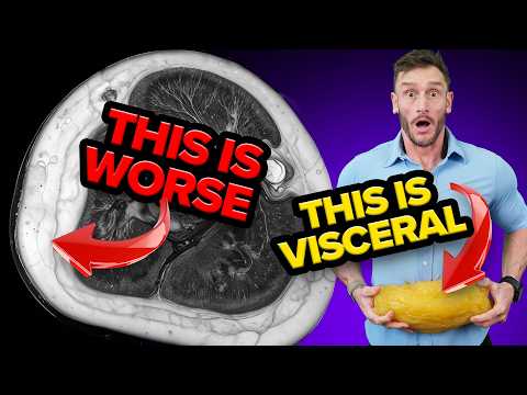 Up to 10-Fold More Dangerous than Visceral Belly Fat - How to Get Rid of Myosteatosis
