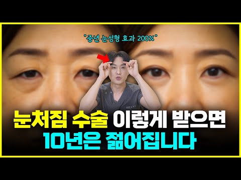 눈꺼풀 처짐 이렇게 하시면 10년 젊어집니다 (Feat. 눈꺼풀처짐 수술 효과 및 부작용 수술후 관리법 총정리)