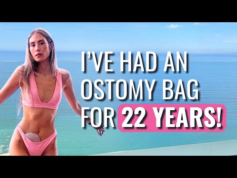 The Stomach Flu Triggered My Diagnosis! - Jessica | Crohn's Disease | The Patient Story