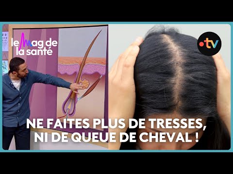 Alopécie : nos conseils pour prévenir la perte de cheveux