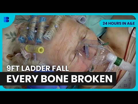 Builder's 9ft Fall Breaks Multiple Bones at St George's | 24 Hours In A&E