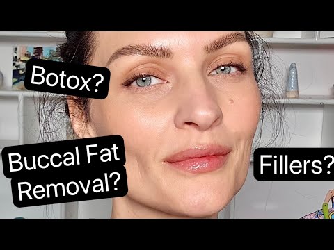 Fillers? Botox? Here’s what I’ve had and why