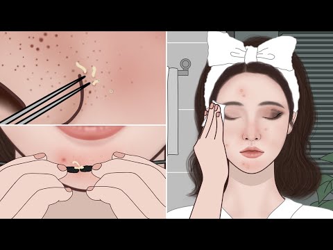 Oddly Satisfying ASMR Animation: Pimple Popping + Blackhead Removal ✨ Night Skincare Routine