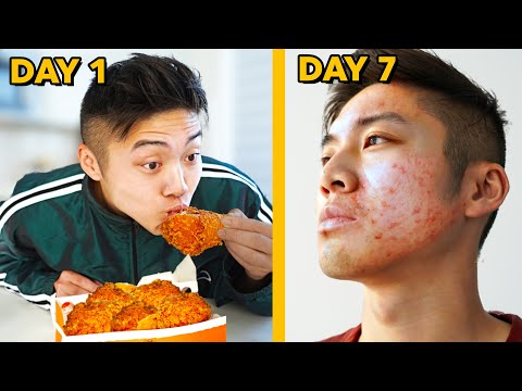 Only Eating Foods that GUARANTEE ACNE for 7 Days Straight