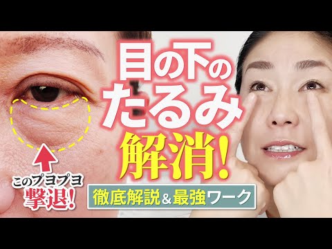 [Complete Edition] How to get rid of puffiness under your eyes