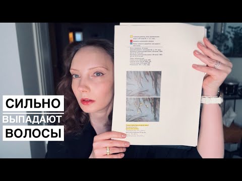 Телогеновое выпадение волос. Андрогенетическая алопеция. Моя история и лечение