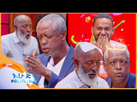 /የቃጠሎ ፍልሚያ/  "አዲስ አበባን 5 አመት ይበልጣታል🤣 አቃጣይ አሳበህ አልቅስ"🤣🤣 //እሁድን በኢቢኤስ//
